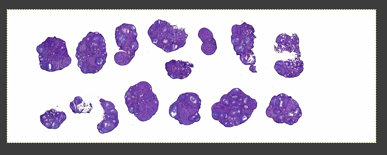 Effect After Tissue Extraction
